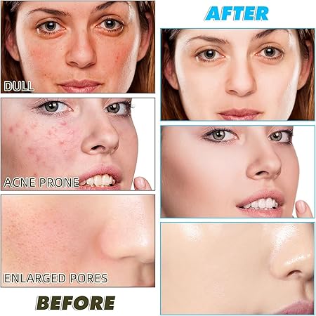 Kojic Acid and turmeric Cleansing Pads (50Pcs)